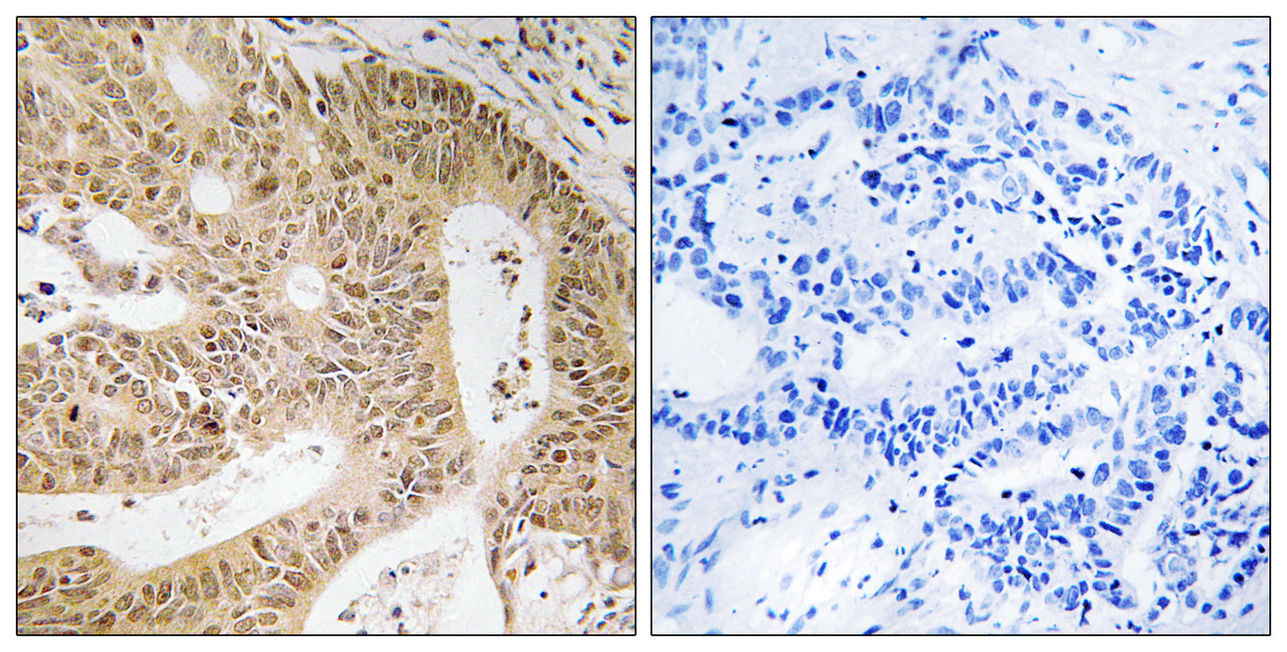 DAP-1 Rabbit Polyclonal Antibody