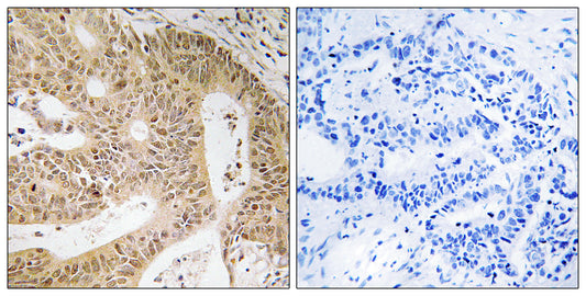 DAP-1 Rabbit Polyclonal Antibody
