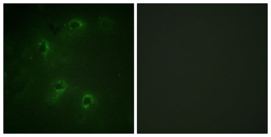DAPK1 Rabbit Polyclonal Antibody