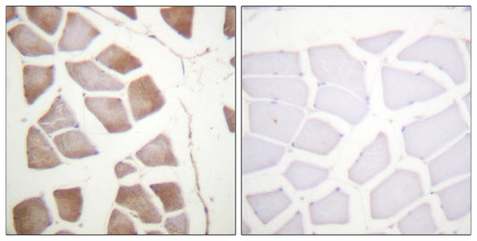 DAPK2 Rabbit Polyclonal Antibody