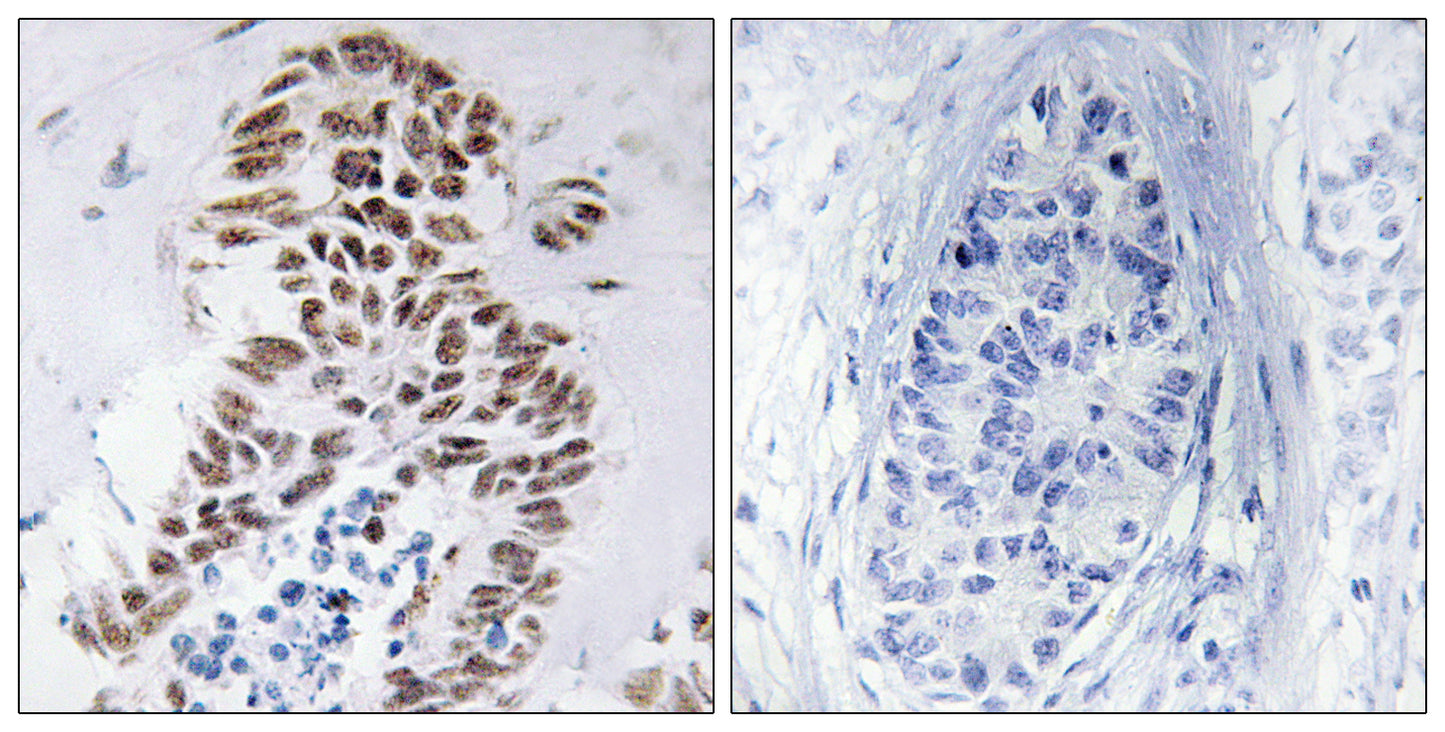 DAPK3 Rabbit Polyclonal Antibody