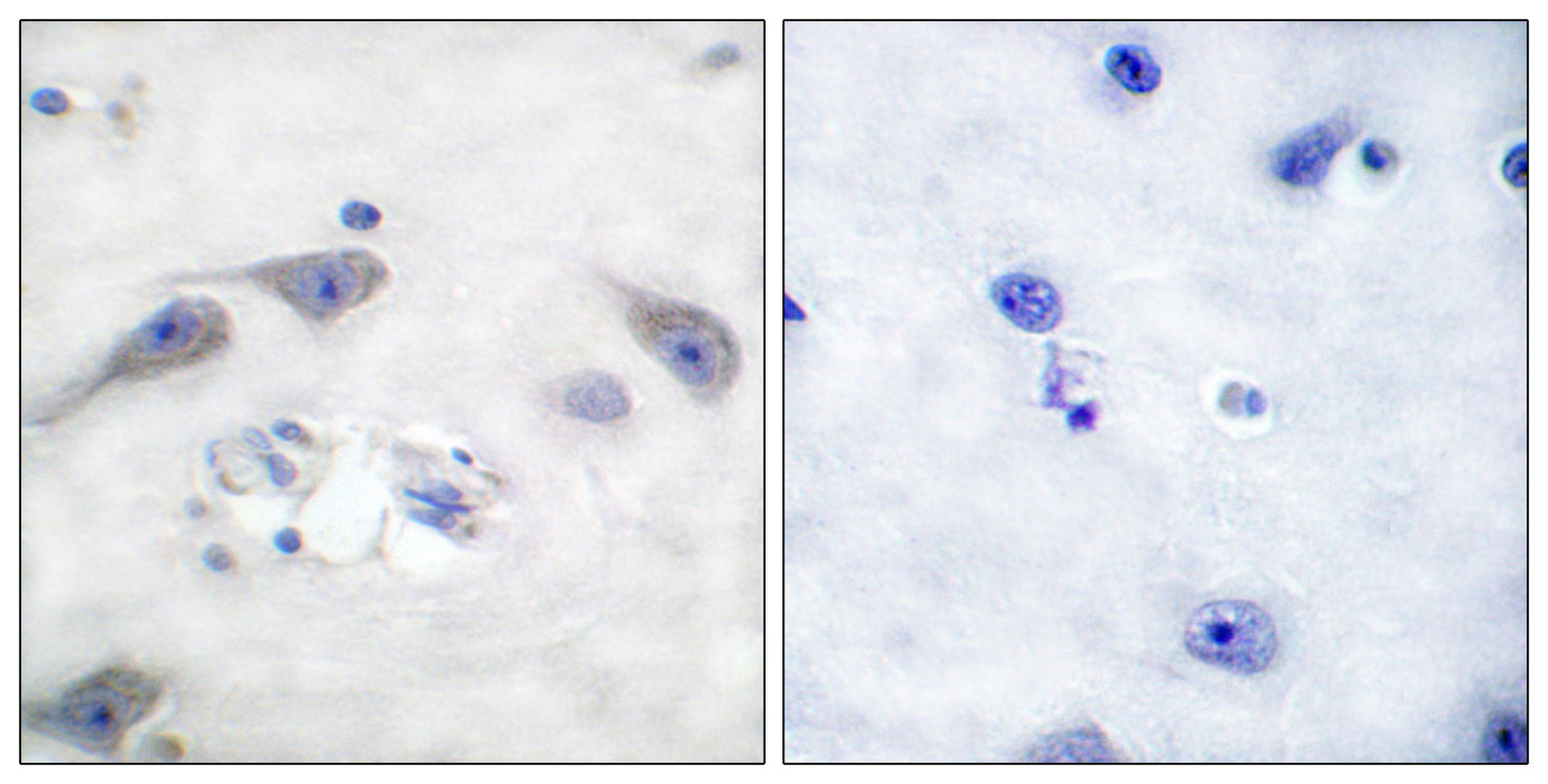 DARPP-32 Rabbit Polyclonal Antibody