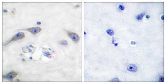 DARPP-32 Rabbit Polyclonal Antibody