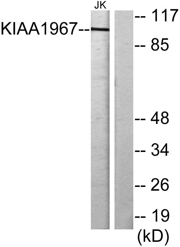 DBC-1 Rabbit Polyclonal Antibody
