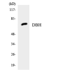 DBH Rabbit Polyclonal Antibody