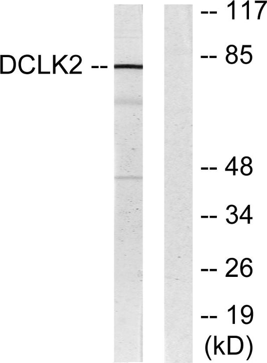 DCAMKL2 Rabbit Polyclonal Antibody