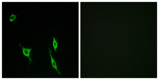 DCC Rabbit Polyclonal Antibody