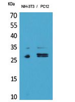 DcR1 Rabbit Polyclonal Antibody
