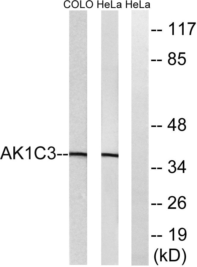 DD3 Rabbit Polyclonal Antibody