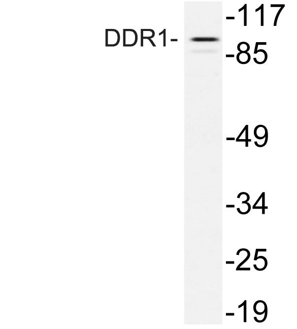 DDR1 Rabbit Polyclonal Antibody
