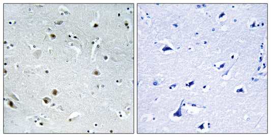 DDX24 Rabbit Polyclonal Antibody