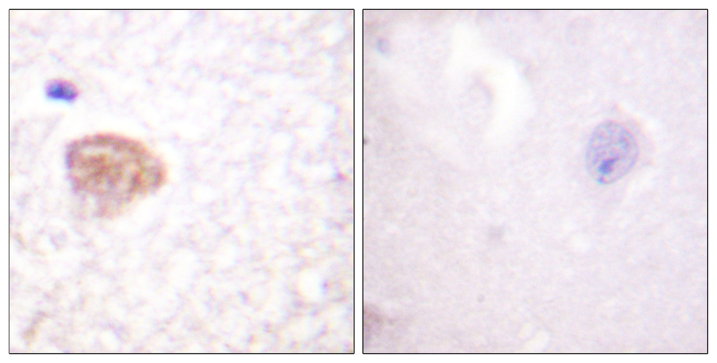 DDX3 Rabbit Polyclonal Antibody