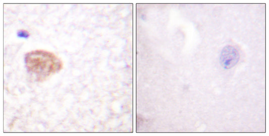 DDX3 Rabbit Polyclonal Antibody