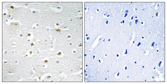 DDX3Y Rabbit Polyclonal Antibody