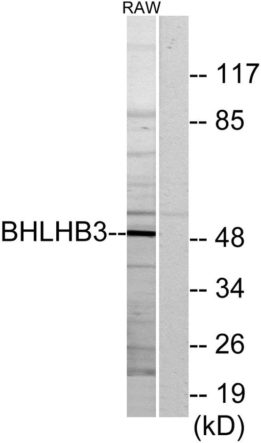 DEC2 Rabbit Polyclonal Antibody