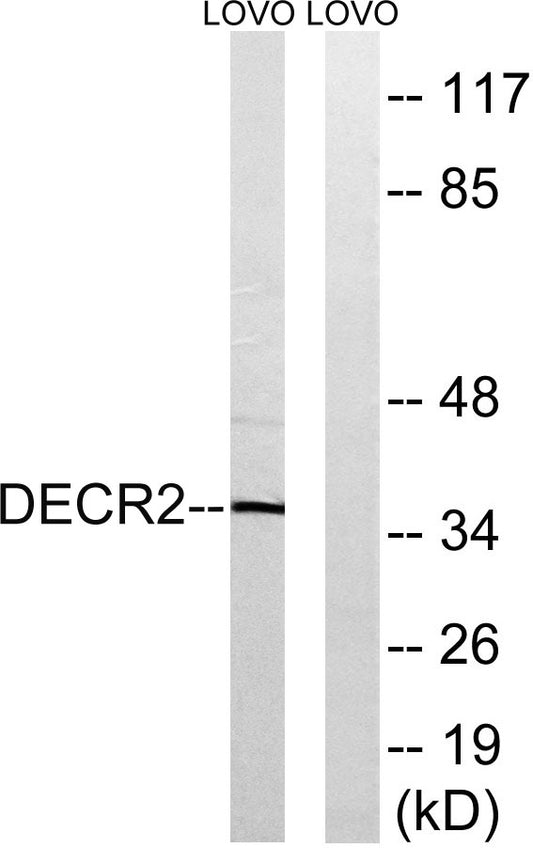 DECR2 Rabbit Polyclonal Antibody