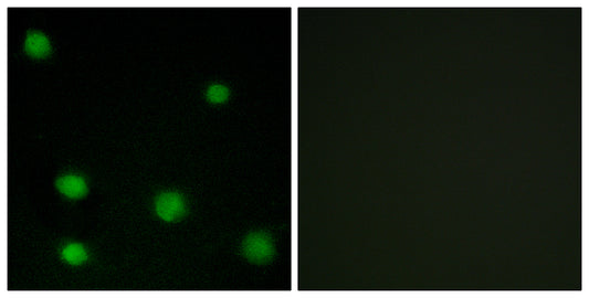 DEF-3 Rabbit Polyclonal Antibody
