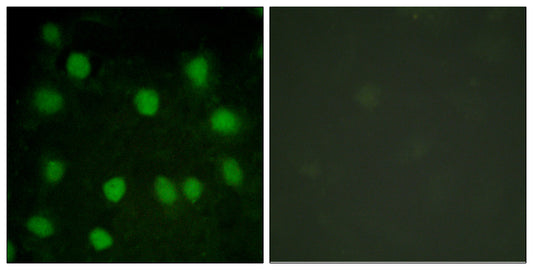 Dematin Rabbit Polyclonal Antibody