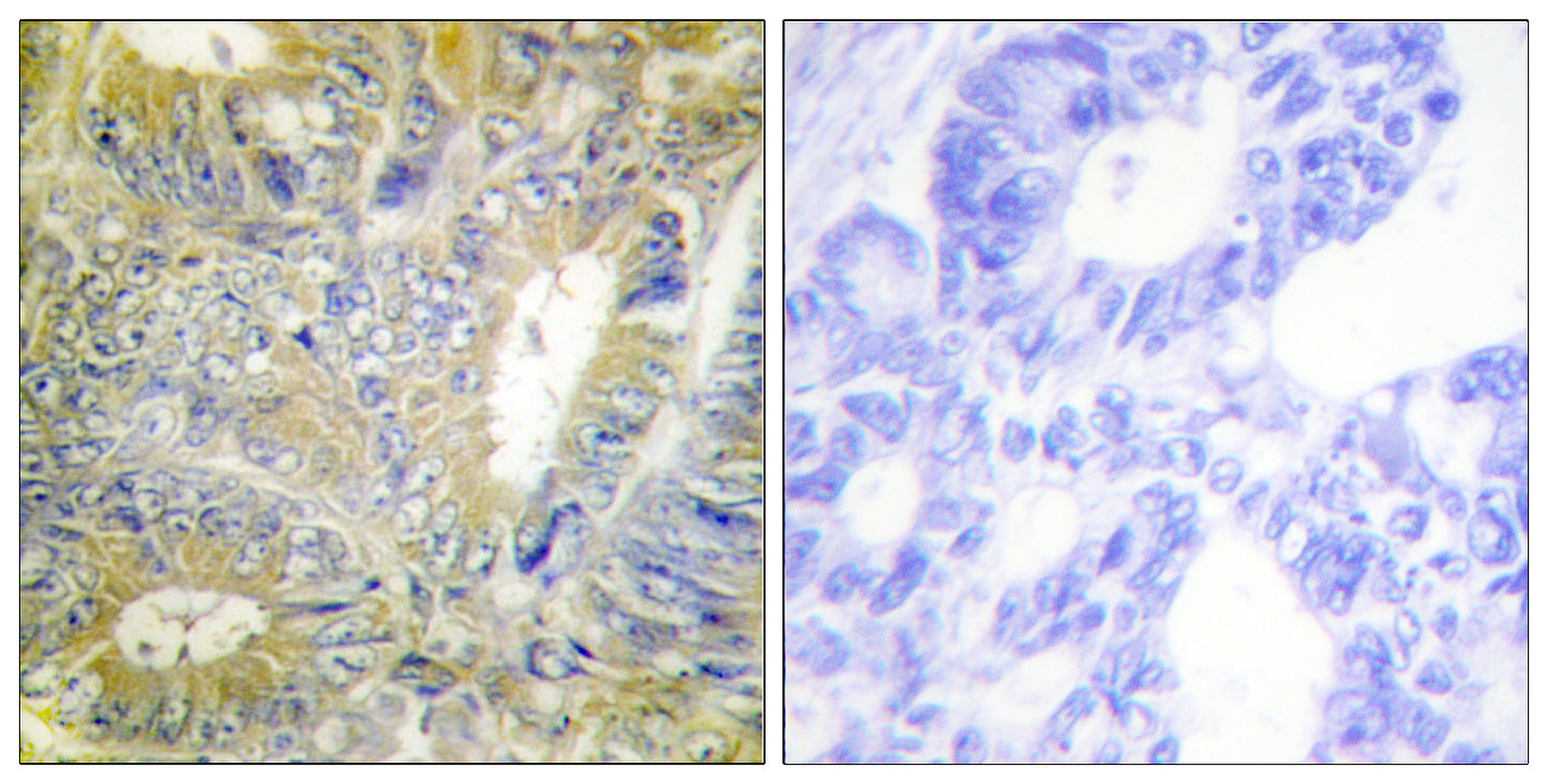 Desmin Rabbit Polyclonal Antibody