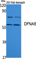 DFNA5 Rabbit Polyclonal Antibody