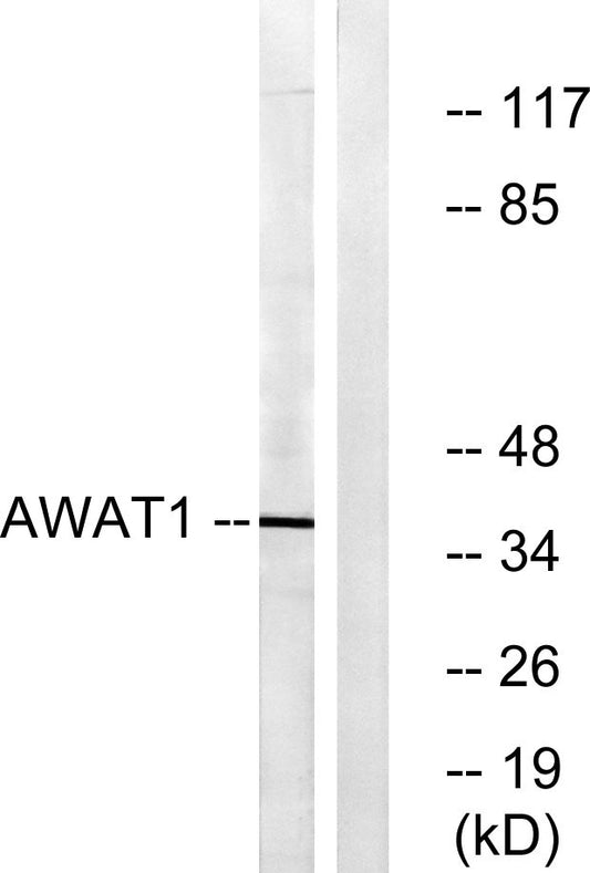 DGAT2L3 Rabbit Polyclonal Antibody