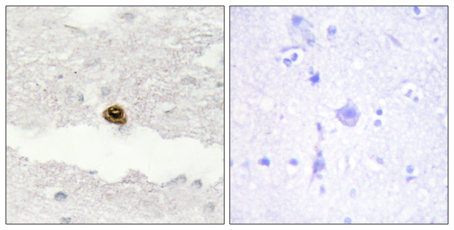 DGK-ζ Rabbit Polyclonal Antibody
