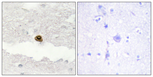 DGK-ζ Rabbit Polyclonal Antibody