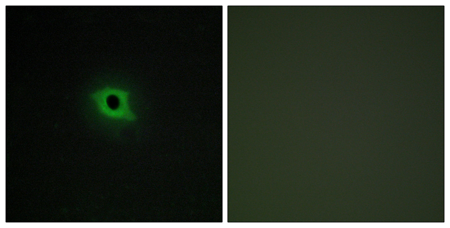 DGK-κ Rabbit Polyclonal Antibody