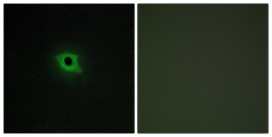 DGK-κ Rabbit Polyclonal Antibody
