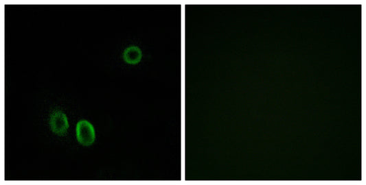 D-GPCR Rabbit Polyclonal Antibody