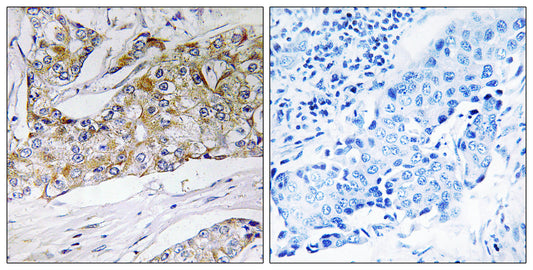 DHRS11 Rabbit Polyclonal Antibody
