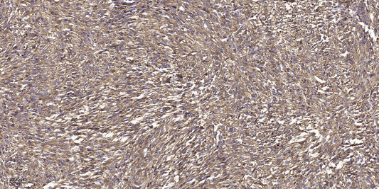 DIAP2 Rabbit Polyclonal Antibody
