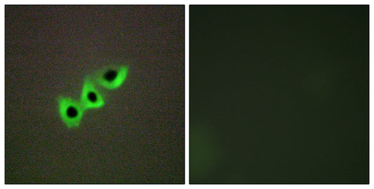 DLC-1 Rabbit Polyclonal Antibody