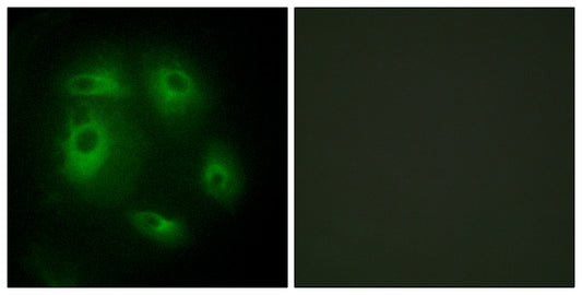 DLEC1 Rabbit Polyclonal Antibody