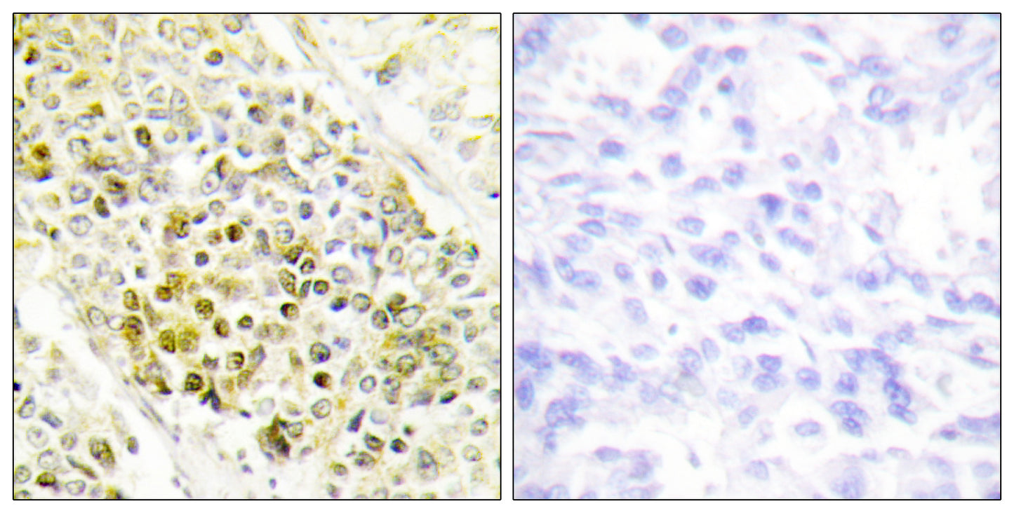 Dlx-5 Rabbit Polyclonal Antibody