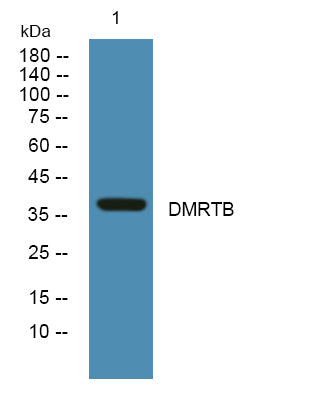 DMRTB Rabbit Polyclonal Antibody