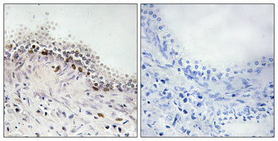 DNA Ligase IV Rabbit Polyclonal Antibody