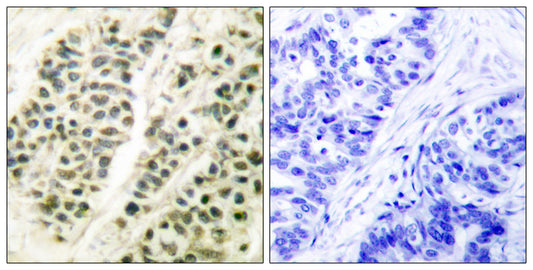 DNA pol β Rabbit Polyclonal Antibody
