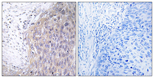 DNA pol γ2 Rabbit Polyclonal Antibody