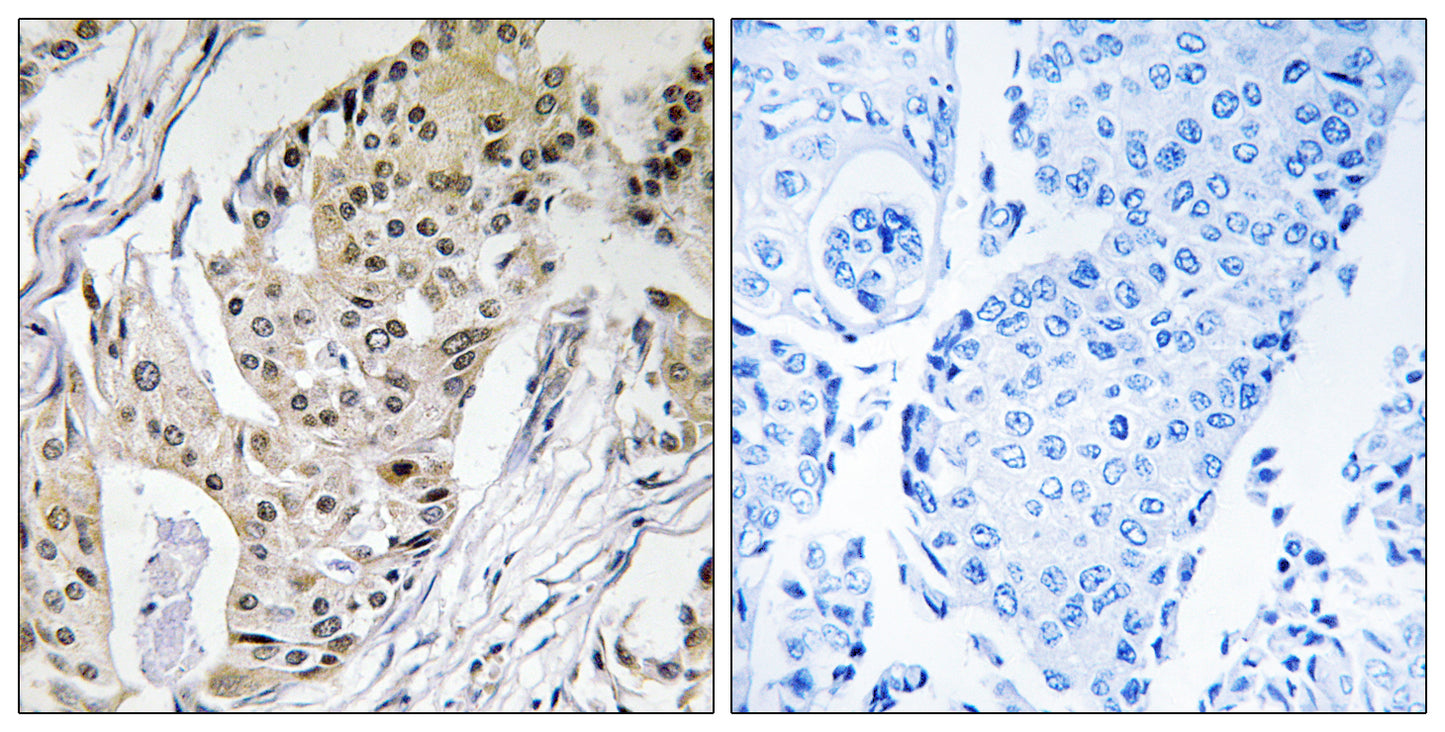 DNA pol ε 4 Rabbit Polyclonal Antibody