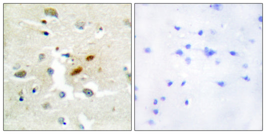 DNA pol ζ Rabbit Polyclonal Antibody