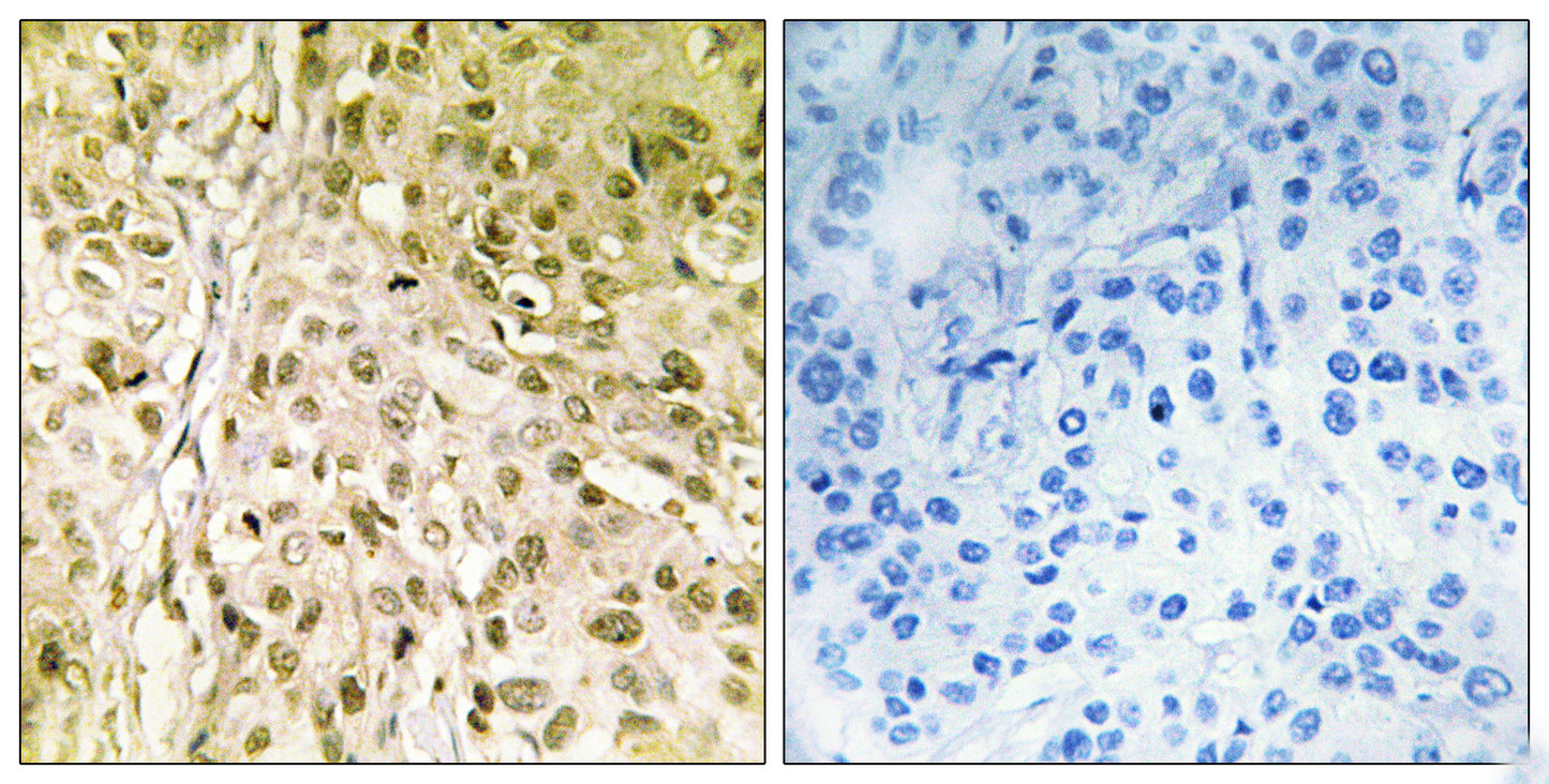 DNA pol θ Rabbit Polyclonal Antibody