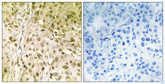 DNA pol θ Rabbit Polyclonal Antibody