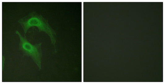 DNAM-1 Rabbit Polyclonal Antibody