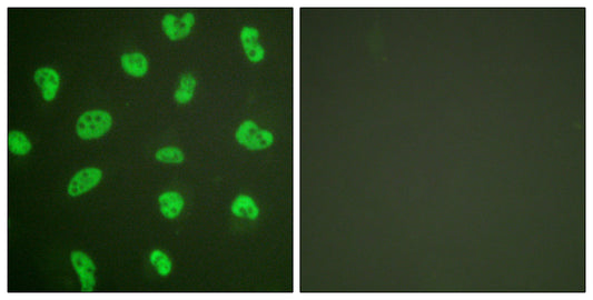 DNA-PKCS Rabbit Polyclonal Antibody