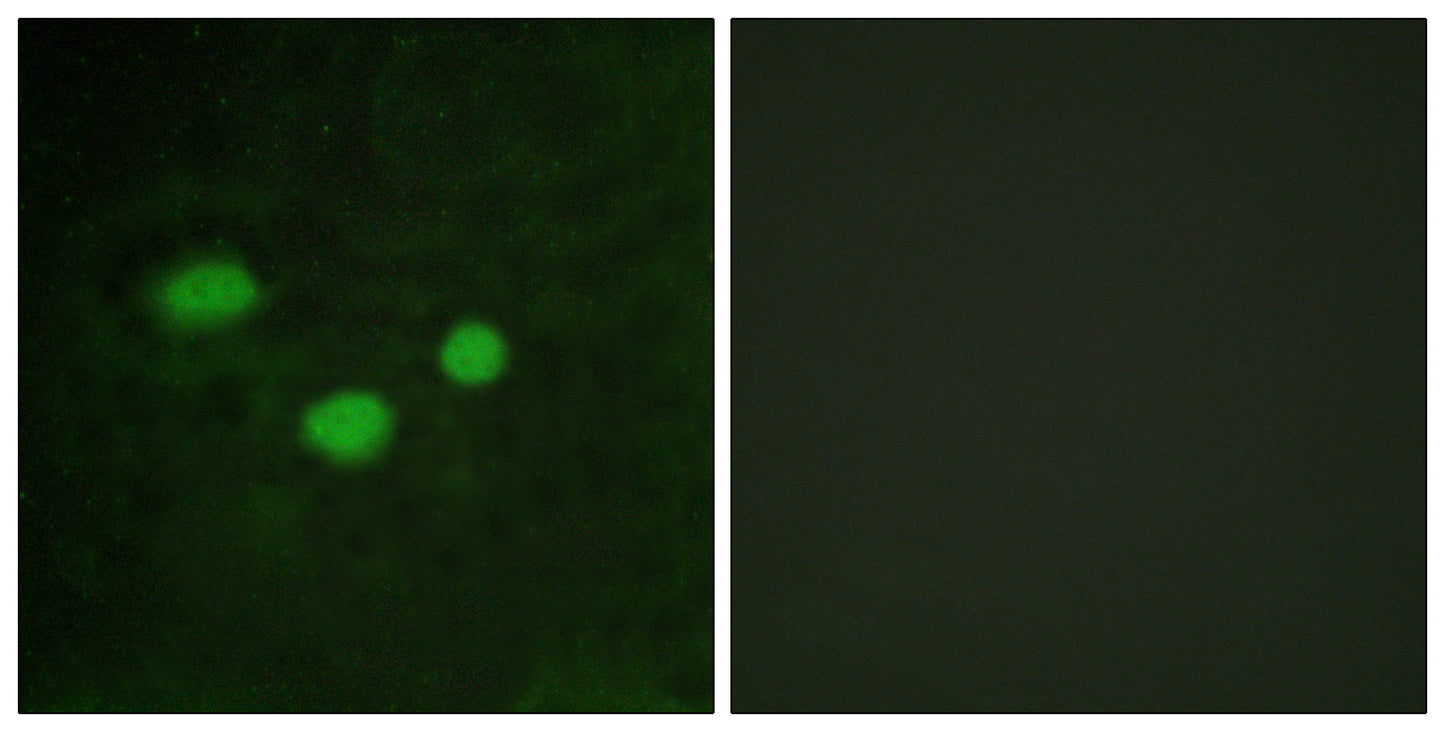 Dnmt3b Rabbit Polyclonal Antibody