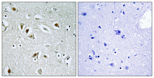 DOC-1R Rabbit Polyclonal Antibody