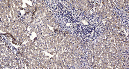 DOCK 2 Rabbit Polyclonal Antibody