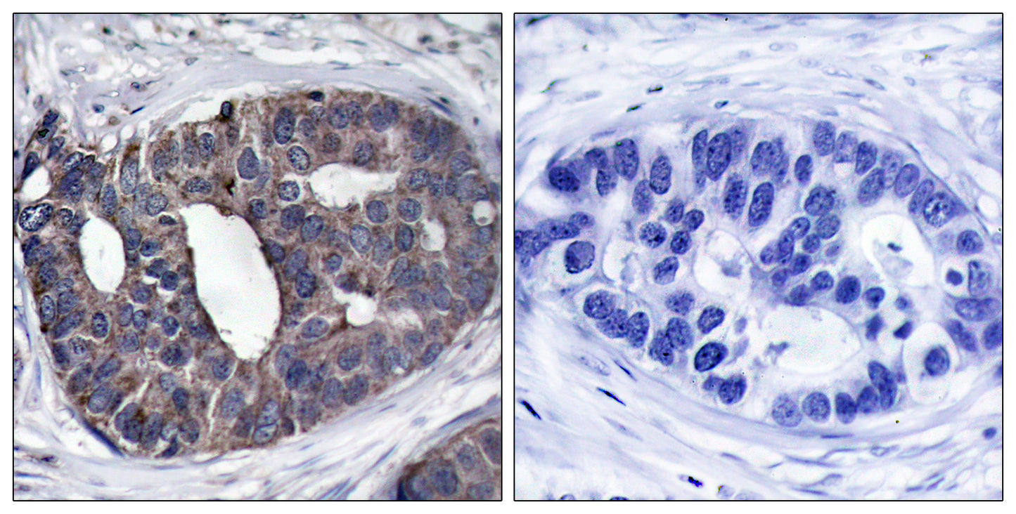 Dok-1 Rabbit Polyclonal Antibody