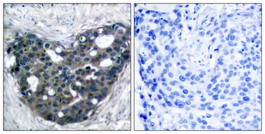 Dok-2 Rabbit Polyclonal Antibody